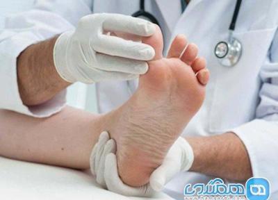 تمرین های ورزشی برای بهتر شدن قوز شست پا